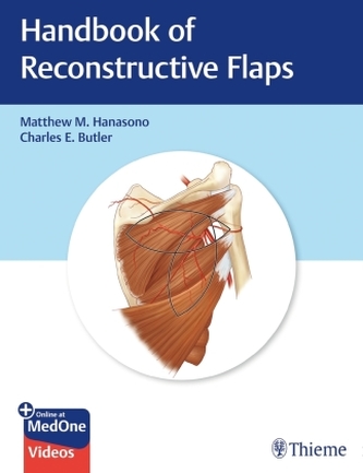 MD Anderson Handbook of Reconstructive Flaps