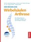 Der Rücken-Doc: Wirbelsäulen-Arthrose