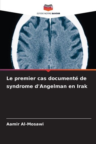 Le premier cas documenté de syndrome d'Angelman en Irak