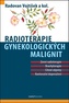 Radioterapie gynekologických malignit