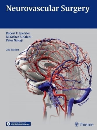 Neurovascular Surgery