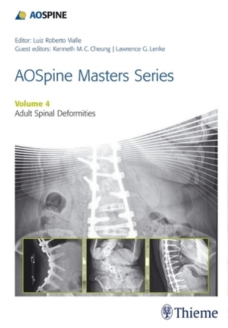 AOSpine Master Series - Adult Spinal Deformities