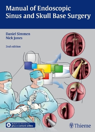 Manual of Endoscopic Sinus Surgery