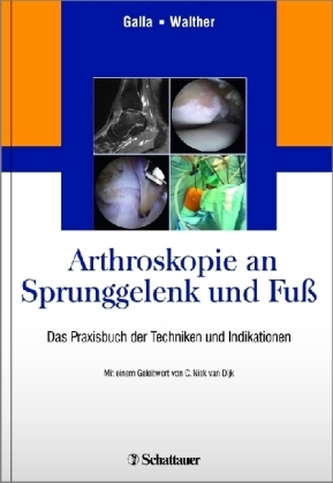 Arthroskopie an Sprunggelenk und Fuß